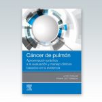 Cancer-de-pulmon-Aproximacion