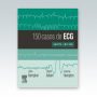 150-casos-de-ECG
