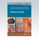 Cancer-de-piel-Journal