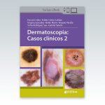 Dermatoscopia-Casos-clinicos-2
