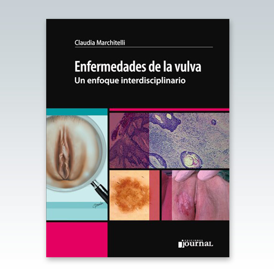 Definición de vulva - Diccionario de cáncer del NCI - NCI