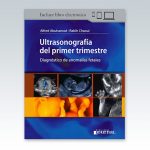 Ultrasonografia-del-primer-trimestre