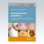 Dermatoscopia-Pediatrica