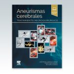 Aneurismas-cerebrales