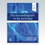 Electrocardiografia-de-las-arritmias