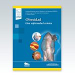 Obesidad