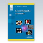 Ecocardiografía-Avanzada