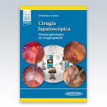 Cirugia-laparoscopica