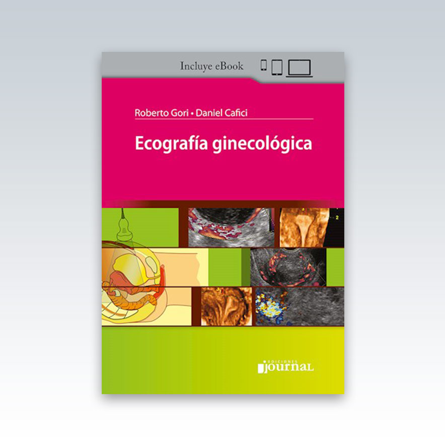 Ecografía Ginecológica. 2ª Edición – 2023 - Edimeinter