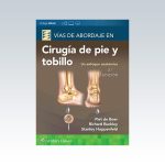 ías-de-abordaje-de-cirugía-de-pie-y-tobillo