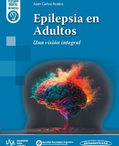 Epilepsia en Adultos. Una visión integral. Incluye eBook. 1ª Edición – 2024