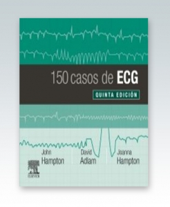 150 casos de ECG. 5ª Edición – 2019