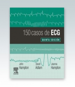 150 casos de ECG. 5ª Edición – 2019