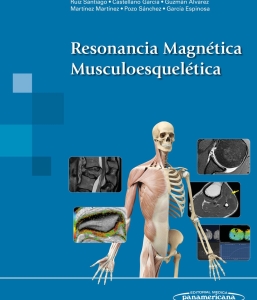 Resonancia Magnética Musculoesquelética. 1ª Edición – 2024