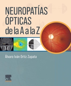 Neuropatías ópticas de la A a la Z – 2024