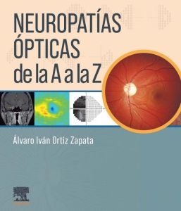 Neuropatías ópticas de la A a la Z – 2024