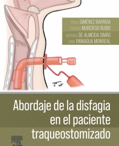 Abordaje de la disfagia en el paciente traqueostomizado – 2024