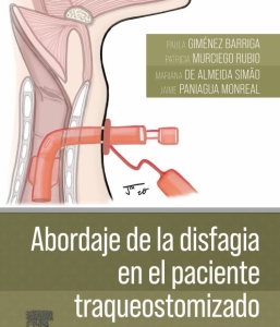 Abordaje de la disfagia en el paciente traqueostomizado – 2024