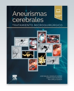 Aneurismas cerebrales – 2022