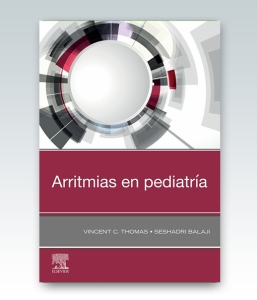 Arritmias en pediatría – 2022