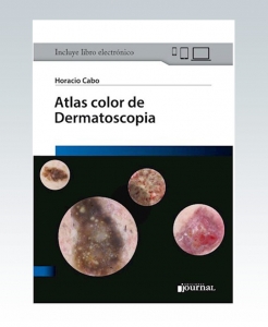 Atlas color de Dermatoscopia – 2020