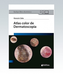 Atlas color de Dermatoscopia – 2020