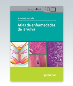 Atlas de enfermedades de la vulva – 2022