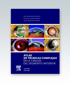 Atlas de técnicas complejas en la cirugía del segmento anterior. Edición 2013