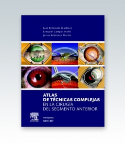 Atlas de técnicas complejas en la cirugía del segmento anterior. Edición 2013