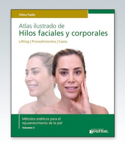 Atlas ilustrado de Hilos faciales y corporales. 1ª Edición – 2020