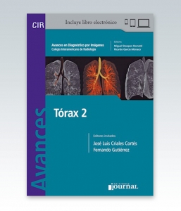 Avances en Diagnóstico por Imágenes: Tórax 2. 1ª Edición – 2019