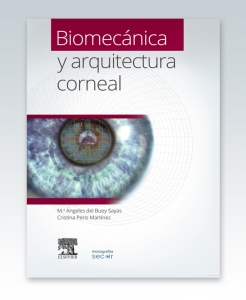 Del Buey Sayas, M.A., Biomecánica y arquitectura corneal © 2015