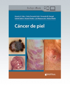 Cáncer de piel. 1ª Edición – 2021