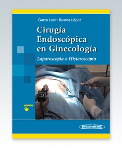 Cirugía Endoscópica en Ginecología. Laparoscopía e Histeroscopía