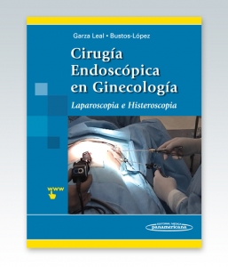 Cirugía Endoscópica en Ginecología. Laparoscopía e Histeroscopía