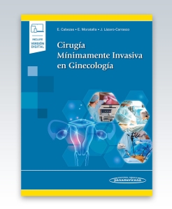 Cirugía Mínimamente Invasiva en Ginecología. 1ª Edición – 2023