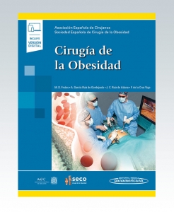 Cirugía de la Obesidad. Incluye Ebook – 2020