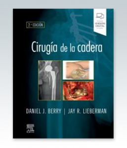 Cirugía de la cadera. 2ª Edición – 2021