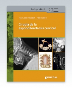 Cirugía de la espondiloartrosis cervical. 1ª Edición – 2021