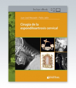 Cirugía de la espondiloartrosis cervical. 1ª Edición – 2021