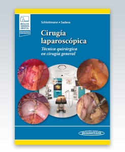 Cirugía laparoscópica. 1ª Edición – 2023