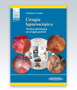 Cirugía laparoscópica. 1ª Edición – 2023