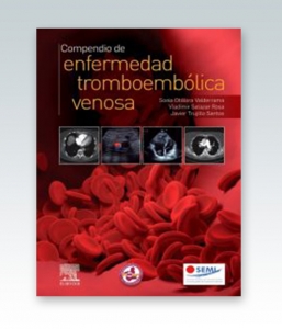 Compendio de enfermedad tromboembólica venosa – 2020