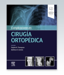 Complicaciones en cirugía ortopédica – 2021