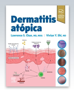 Dermatitis atópica. 1ª Edición – 2023