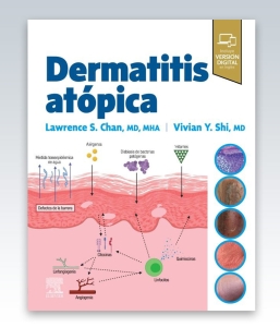 Dermatitis atópica. 1ª Edición – 2023