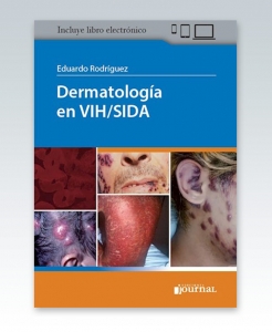 Dermatología en VIH/SIDA. 1ª Edición – 2021