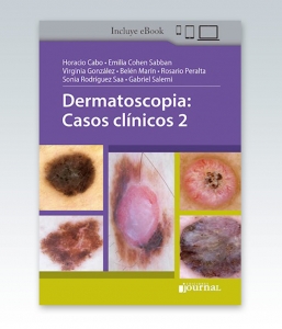 Dermatoscopia: Casos clínicos – 2021