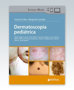 Dermatoscopia Pediátrica – 2021