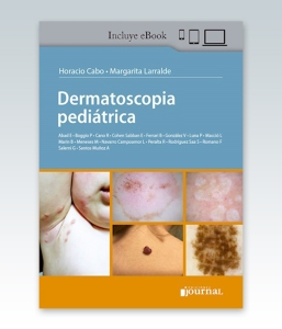 Dermatoscopia Pediátrica – 2021